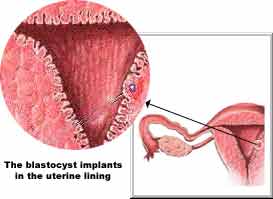 The blastocyst shown embedded in the mother's womb (the uterine lining)